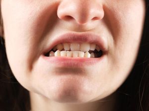 Viral Istilah Mewing di Medsos, Termasuk Operasi Plastik? Ini Penjelasannya Viral Istilah Mewing di Medsos, Termasuk Operasi Plastik? Ini Penjelasannya