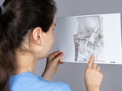 Mewing Sebenarnya Bukan Bahasa Gaul? Begini Penjelasannya