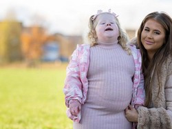 Anaknya Tak Bisa Berhenti Makan, Ibu Ini Pasang Pagar di Dapurnya