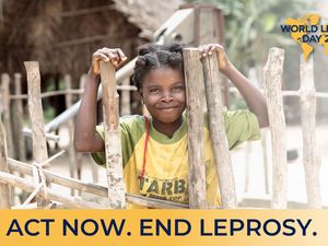 Hari Kusta Sedunia 2023: Tema, Hashtag, Contoh Ucapan dan Twibbonnya