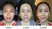 6 Potret Titi DJ Jalani Prosedur Anti Aging Surgery di Korsel, Begini Hasilnya