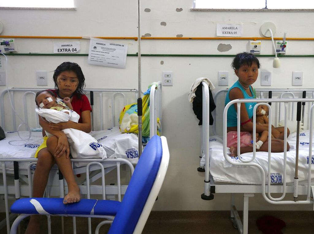 Kasihan, Anak-anak di Brasil Darurat Gizi Buruk-Malaria