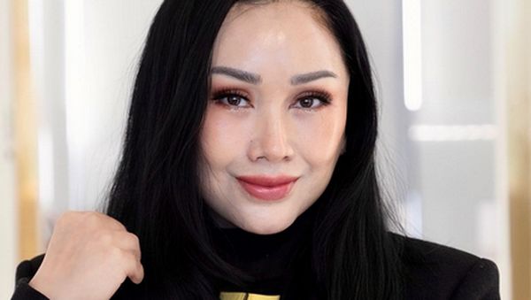 9 Foto Wajah Baru Titi DJ Setelah Operasi Plastik, Jadi Begini
