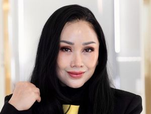 9 Foto Wajah Baru Titi DJ Setelah Operasi Plastik, Jadi Begini