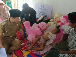 Kondisi Balita Trenggalek Korban Peluru Nyasar Senapan Angin Mulai Membaik