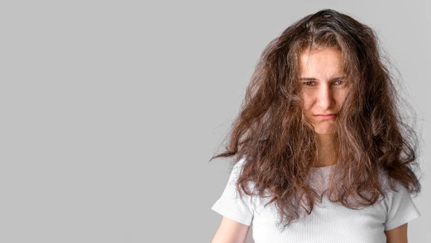 Rambut Menjadi Kering / foto : freepik Rambut Menjadi Kering / foto : freepik