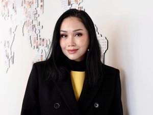 Cerita Titi DJ Oplas di Korea, Wajahnya Kini Disebut bak Usia 35 Tahun Cerita Titi DJ Oplas di Korea, Wajahnya Kini Disebut bak Usia 35 Tahun