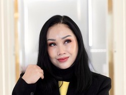 Curhat Titi DJ Ceritakan Rasanya Oplas Anti Aging, Cuma Memar Dikit