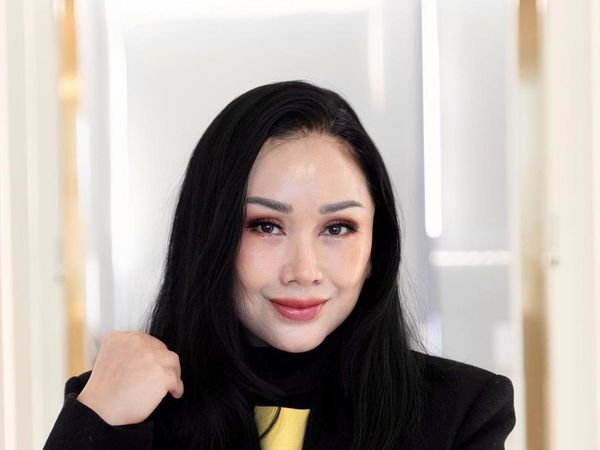 7 Potret Wajah Baru Titi DJ Pasca Oplas Anti Aging di Korsel