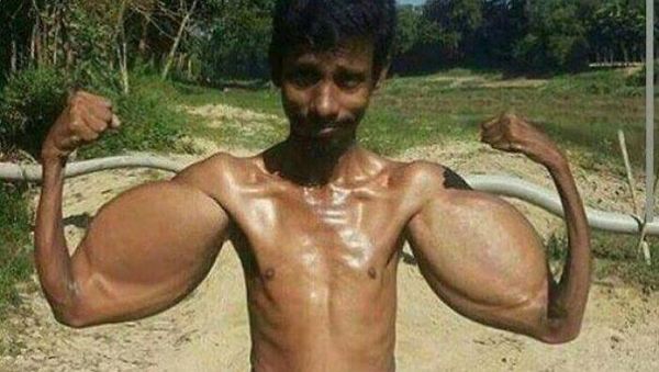 Editan Photoshop Berlebih Bikin Ngakak Parah