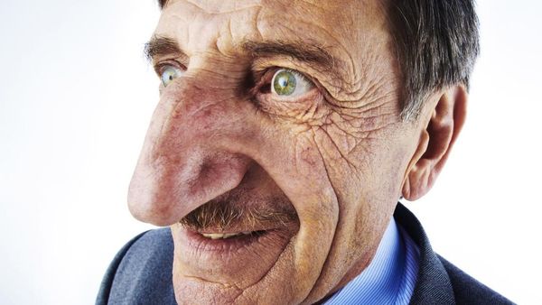 Potret Orang dengan Ciri Fisik Luar Biasa Bikin Kaget Tak Percaya