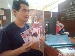 Pilu Hati Ortu di Palembang Tersayat Sebab Jari Bayi Tergunting Perawat