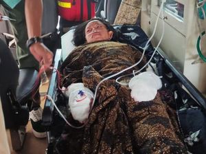 Remaja Kena Ledakan Tabung Gas, Luka Bakar di Wajah dan Sekujur Tubuh