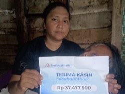 Kesulitan Jualan, Bocah dengan Kelainan Rangka Kepala Terbantu Donasi Sahabat Baik