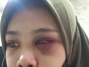 Istri di Mojokerto Babak Belur Dihajar Suami gegara di-VC Teman Pria Istri di Mojokerto Babak Belur Dihajar Suami gegara di-VC Teman Pria
