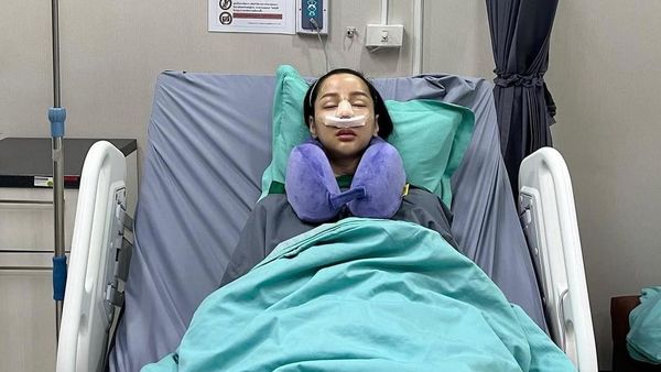 6 Foto Before-After Wajah Baru Lucinta Luna Pasca Oplas Hidung Lagi