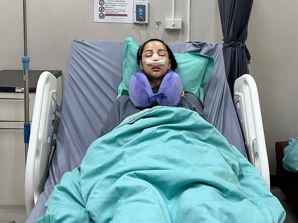 6 Foto Before-After Wajah Baru Lucinta Luna Pasca Oplas Hidung Lagi