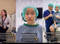 Lucinta Luna Oplas Lagi Ubah Bentuk Hidung gegara Dihujat Mirip Pinokio