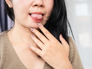 Sariawan Tak Kunjung Sembuh? Bisa Jadi Tanda Imun Lemah Sariawan Tak Kunjung Sembuh? Bisa Jadi Tanda Imun Lemah