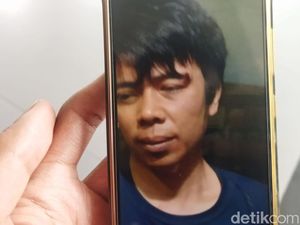 5 Jejak Sadis Ayah Aniaya Mati Bocah di Cimahi 5 Jejak Sadis Ayah Aniaya Mati Bocah di Cimahi