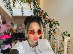 Wanita Ini Punya Implan Payudara Berbobot 10 Kg, Berakhir Pecah