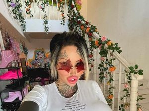 Wanita Ini Punya Implan Payudara Berbobot 10 Kg, Berakhir Pecah Wanita Ini Punya Implan Payudara Berbobot 10 Kg, Berakhir Pecah