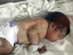 Apa Kabar Bayi Suriah yang Lahir di Bawah Reruntuhan Usai Gempa?
