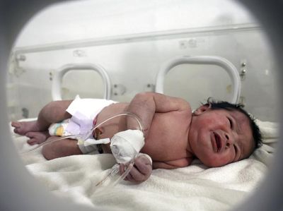Potret Pilu Bayi Baru Lahir Selamat dari Reruntuhan Gempa di Suriah