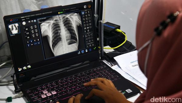 Deteksi Dini Penyakit Tuberkulosis