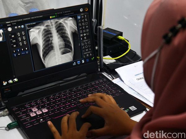 Deteksi Dini Penyakit Tuberkulosis