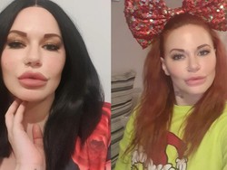 Model Ini Punya Fobia Tinja, Berakhir Pingsan Gegara Tahan Tak BAB 2 Minggu