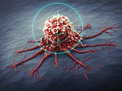 Studi Temukan Lebam Kehijauan di Tangan Bisa Jadi Tanda Tumor Langka