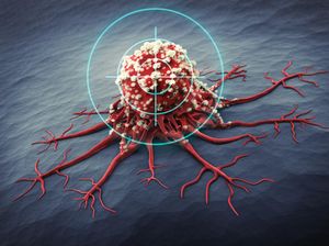 Studi Temukan Lebam Kehijauan di Tangan Bisa Jadi Tanda Tumor Langka Studi Temukan Lebam Kehijauan di Tangan Bisa Jadi Tanda Tumor Langka