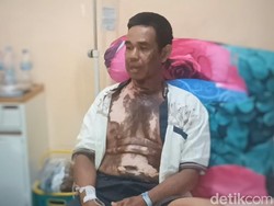 Geger Eks Kades di Sumsel Nyaris Tewas Disiram Air Keras