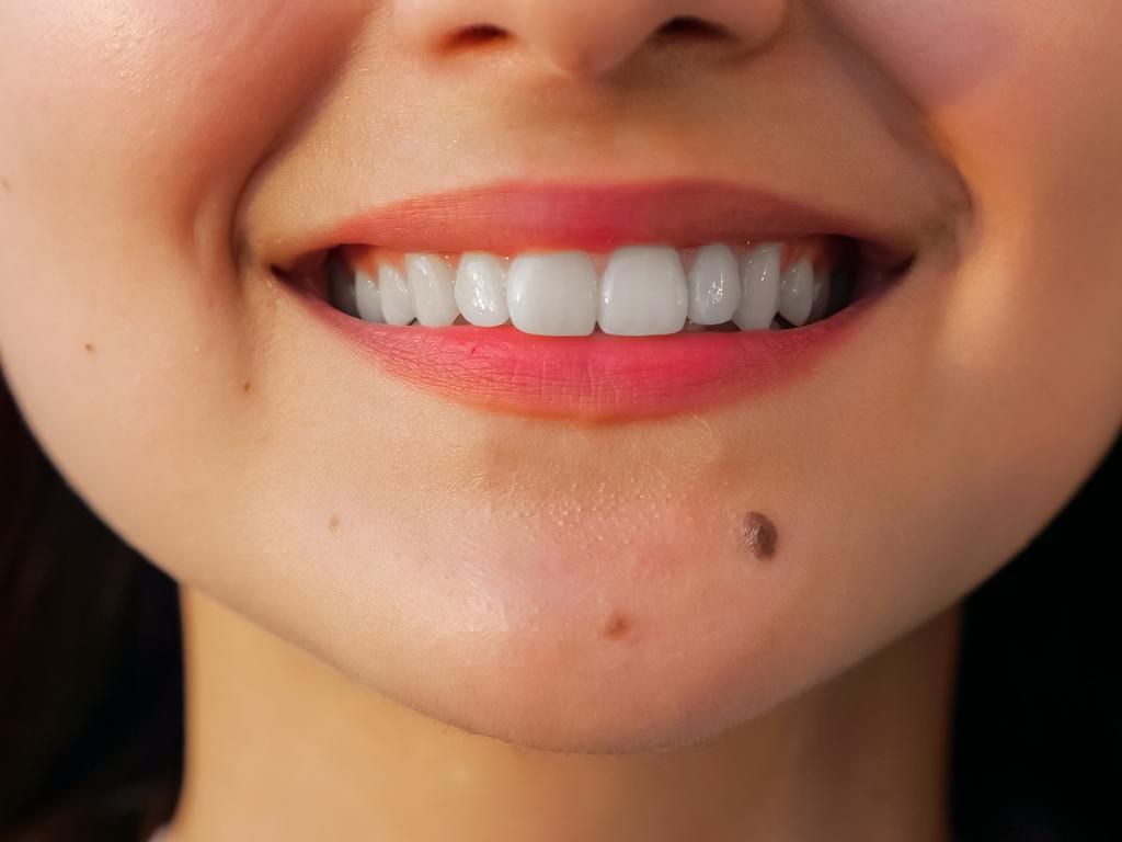 Bagaimana Tahi Lalat Bisa Terbentuk? Bagaimana Tahi Lalat Bisa Terbentuk?