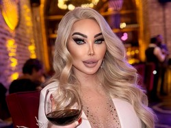 Transgender yang Oplas Lebih dari 100 Kali Kini Jalani Operasi Wajah Ke-5