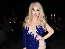 Transgender Barbie Disengat Lebah Hingga Implan Bokongnya Meledak