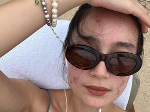 Terpopuler Sepekan: Wajah Tatjana Saphira Tanpa Makeup, PD Pamer Jerawat