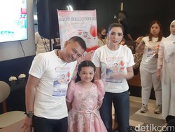 Blak-blakan Ashanty Terkait Pendarahan hingga Sinusitis yang Dialami