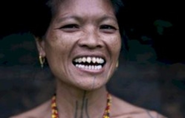 Gigi runcing menjadi tradisi di Mindanao sebagai standar kecantikan