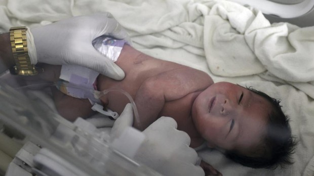 Kondisi bayi Aya sat ini/Foto: Dok. Associated Press Mengulik Kisah Aya, Bayi Yatim Piatu yang Lahir di Reruntuhan Gempa Turki