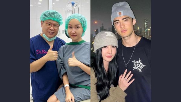 6 Foto Lucinta Luna Pamer Wajah Baru Pasca Operasi Hidung