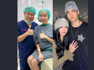 6 Foto Lucinta Luna Pamer Wajah Baru Pasca Operasi Hidung