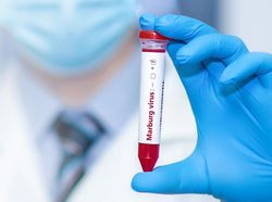 Wanti-wanti WHO soal Angka Kematian Virus Marburg 90 Persen-Risiko Menyebar ke RI