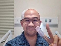 Profil Iwet Ramadhan yang Dibicarakan Gegara Pendarahan Otak