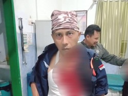 2 Petugas Keamanan Perhutani di Banyuwangi Dibacok, Pelaku Kini Diburu