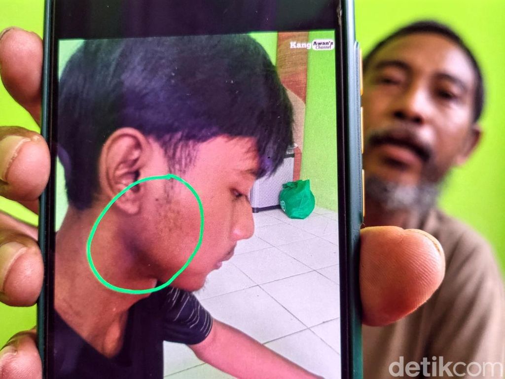 Tragis Pemuda Sukabumi Dikeroyok gegara Cipratan Air Tragis Pemuda Sukabumi Dikeroyok gegara Cipratan Air