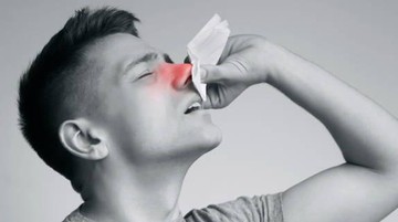 Unik! Pria Bersin dan Pilek Tak Sembuh, Ternyata Ada Benda Asing di Hidungnya. Unik! Pria Bersin dan Pilek Tak Sembuh, Ternyata Ada Benda Asing di Hidungnya.