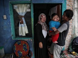 Bayi Obesitas 16 Bulan 27 Kg di Bekasi Dapat Rujukan untuk Periksa di RS