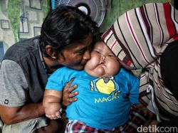 Viral Bayi Setahun Bobotnya Sampai 27 Kg di Bekasi, Ortu Buka Suara